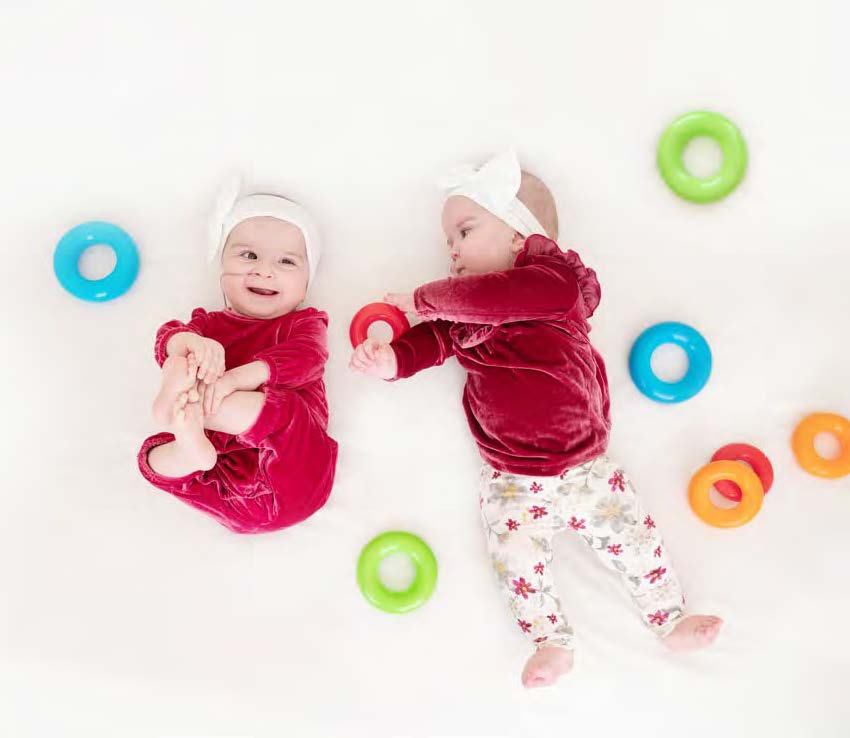 Formerly conjoined twins were featured in UC Davis' annual report.